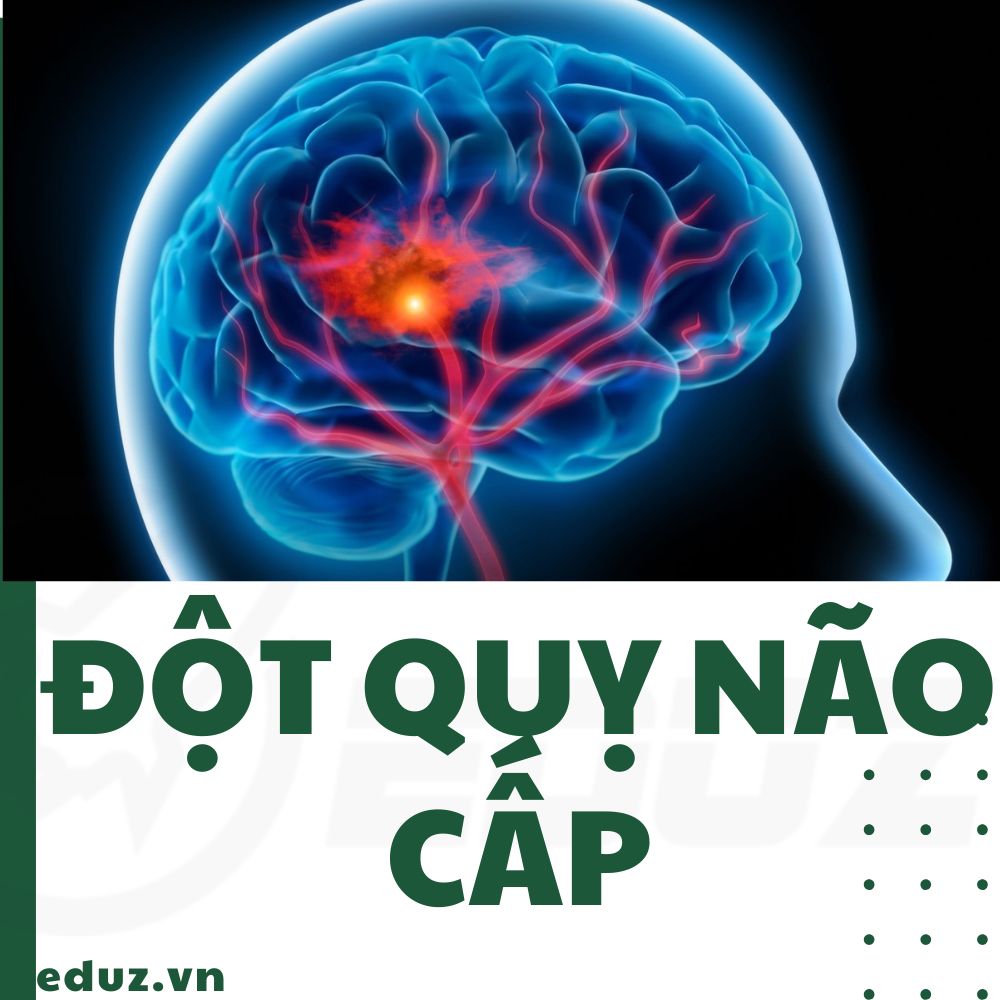 3 Phút Sơ Cứu - Đột Qụy Não Cấp